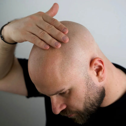 Rakad hårbotten som vårdas med Better Be Bold Bald Peeling från Glamazon